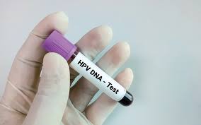 hpv-dna test